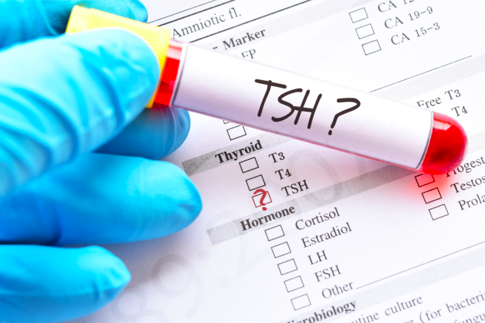 TSH Thyroid Test Tube